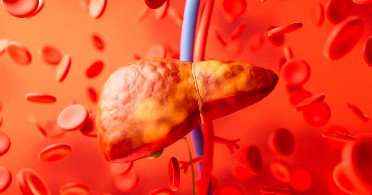 Lebersteatose und Cannabinoide